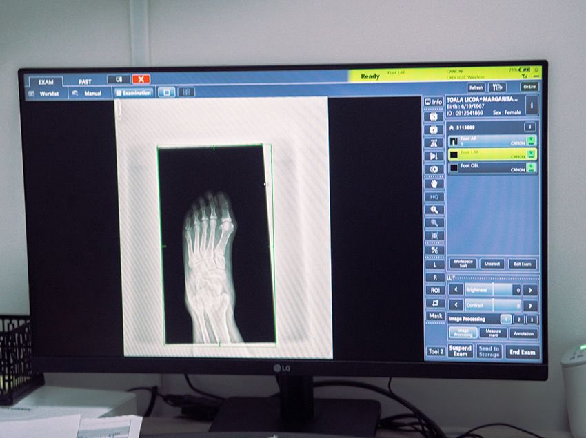 aquilesalvarez's tweet photo. La atención gratuita en radiografías y tomografías del Hospital Municipal Bicentenario se ha convertido en un alivio económico para miles de ciudadanos de Guayaquil y de otras provincias. Solo en 2025 se registraron más de 14.400 atenciones, reflejo de la alta demanda y la confianza en la red municipal de salud.

Para 2026, el Municipio incrementará la inversión a USD 17 millones, alcanzando cerca de 4.000 atenciones gratuitas diarias, con medicinas incluidas, reafirmando un sistema de salud cercano, humano y al servicio de quienes más lo necesitan.

#AsiSeHace
#CiudadDeTodos