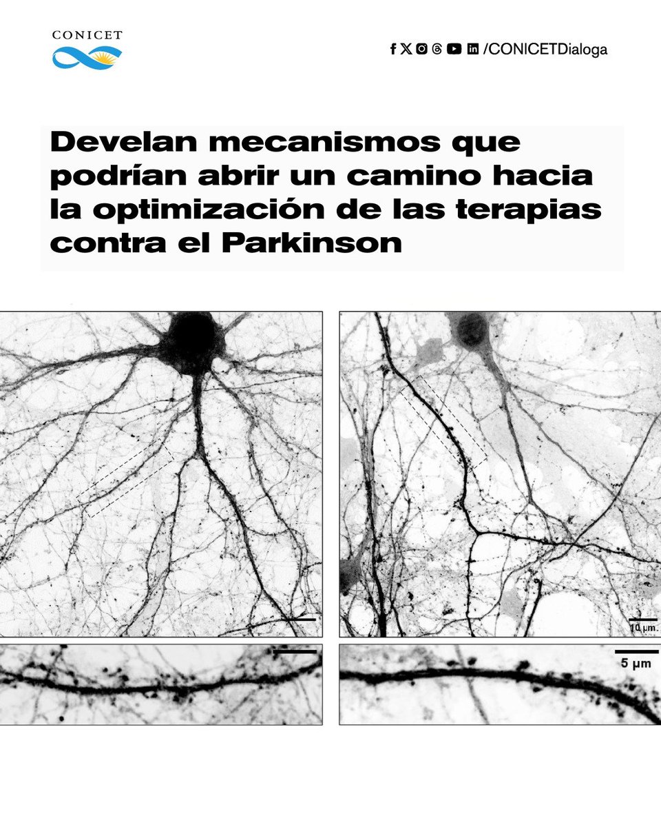 CONICETDialoga's tweet image. 🧠 Parkinson: nuevos hallazgos para mejorar los tratamientos

🔵Un estudio del CONICET, junto a investigadores de la Universidad Grenoble Alpes (Francia), reveló que la L-Dopa, el principal fármaco contra el Parkinson, no solo actúa aumentando la dopamina, sino que también…