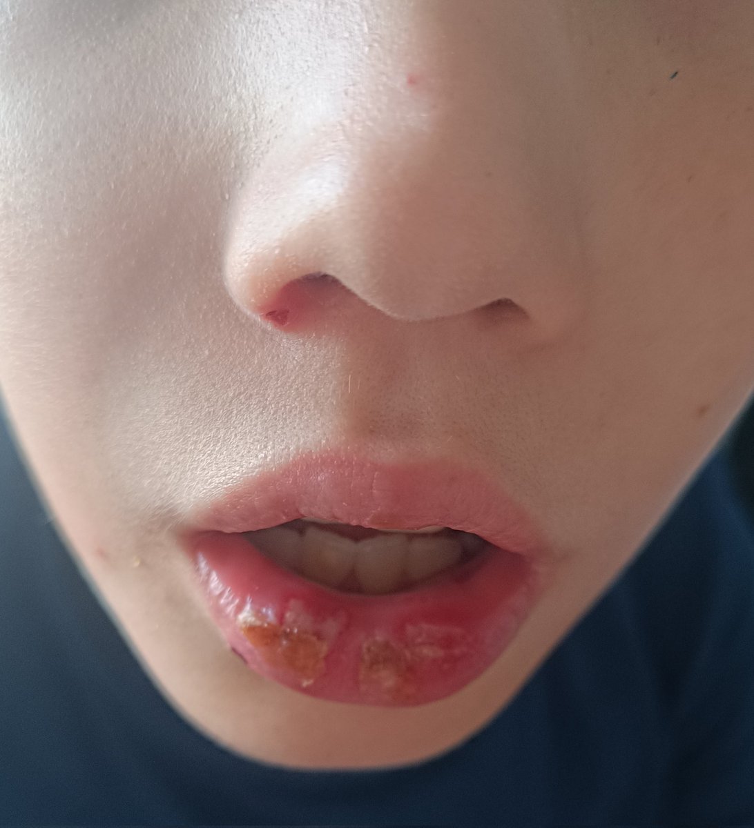 FatmaEvci12's tweet image. Nolur bizi görmezden gelmeyin iki masum yavrum için yardım istiyorum istemek çok zor ama cagresizlik daha zor çocuklarım aç montsuz hasta ilaçlarını alamadım kira ödeyemedim bu kış günü sokakta kalmayalım yavrularım aç yatmasın nolur el uzatın en azından RT yaparak destek nolur