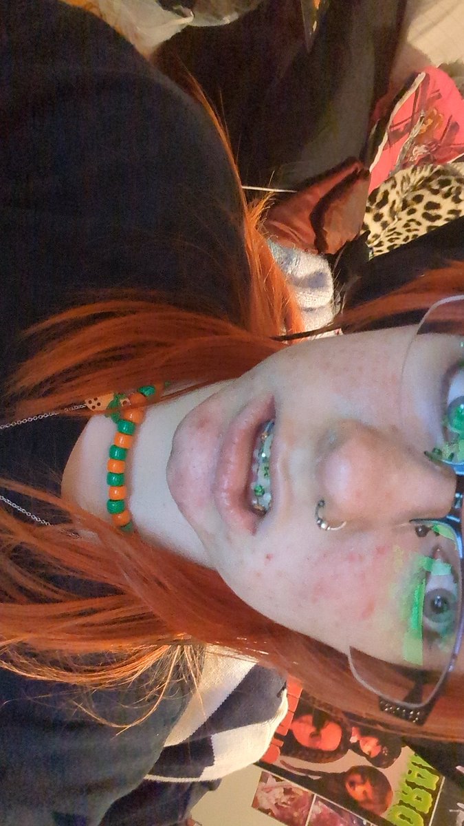 1iconforhirefan's tweet image. Also guys i highkrik got my braces in perriado orange colors Ignore how much of a chopped chud. iam