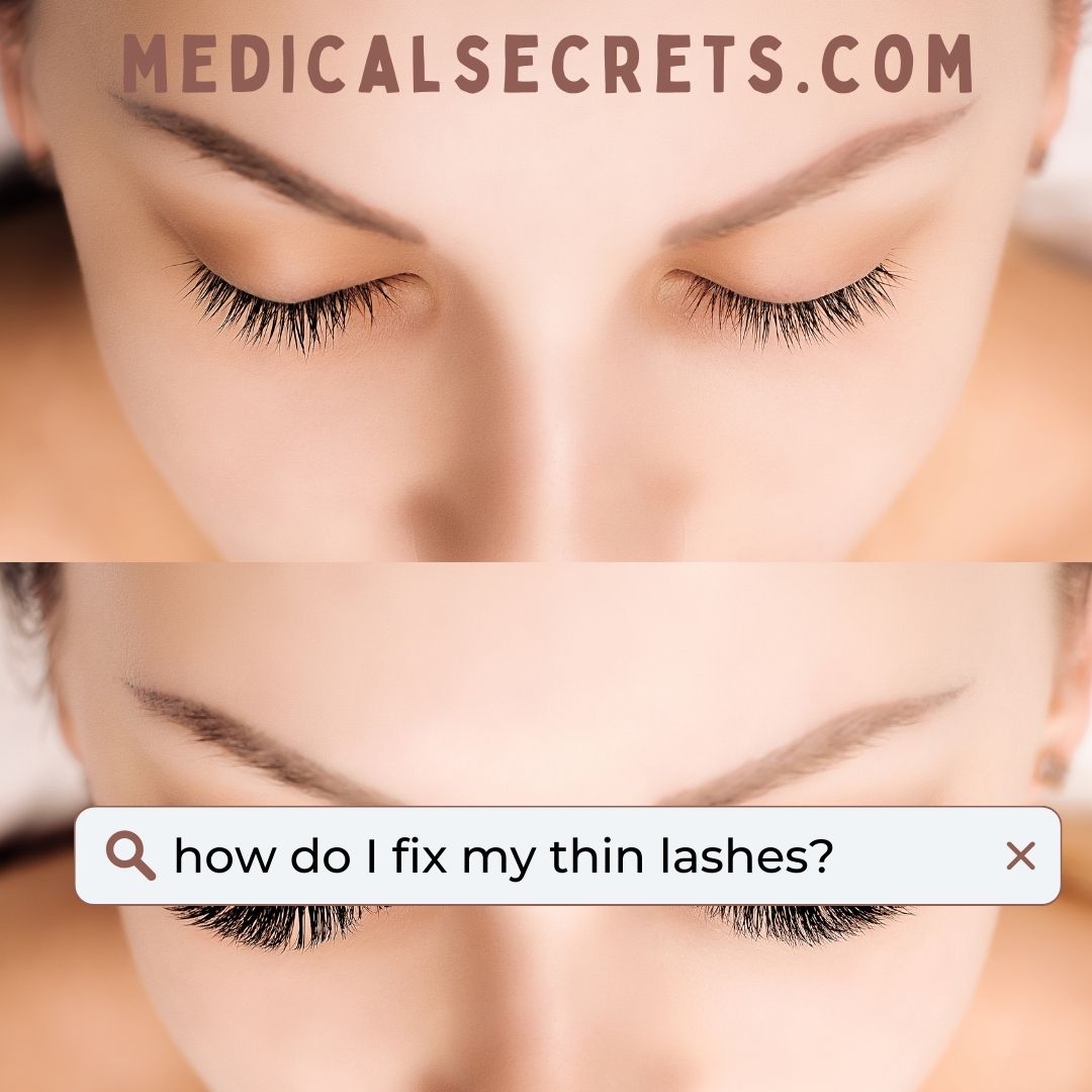 AaronSecrestMD's tweet photo. I'm frequently asked this question. There are affordable options that actually work. My daughter has been using a great OTC product for a few months and has gotten so many compliments!

https://t.co/wKpo7YZdig

#dermatologist #lashgrowth #thinlashes #skincaretips @GrandeLASH https://t.co/ysZfvuCvAA
