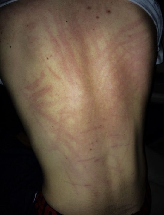 mike leaving will covered in hickies vs will leaving mike covered in scratches send tweet