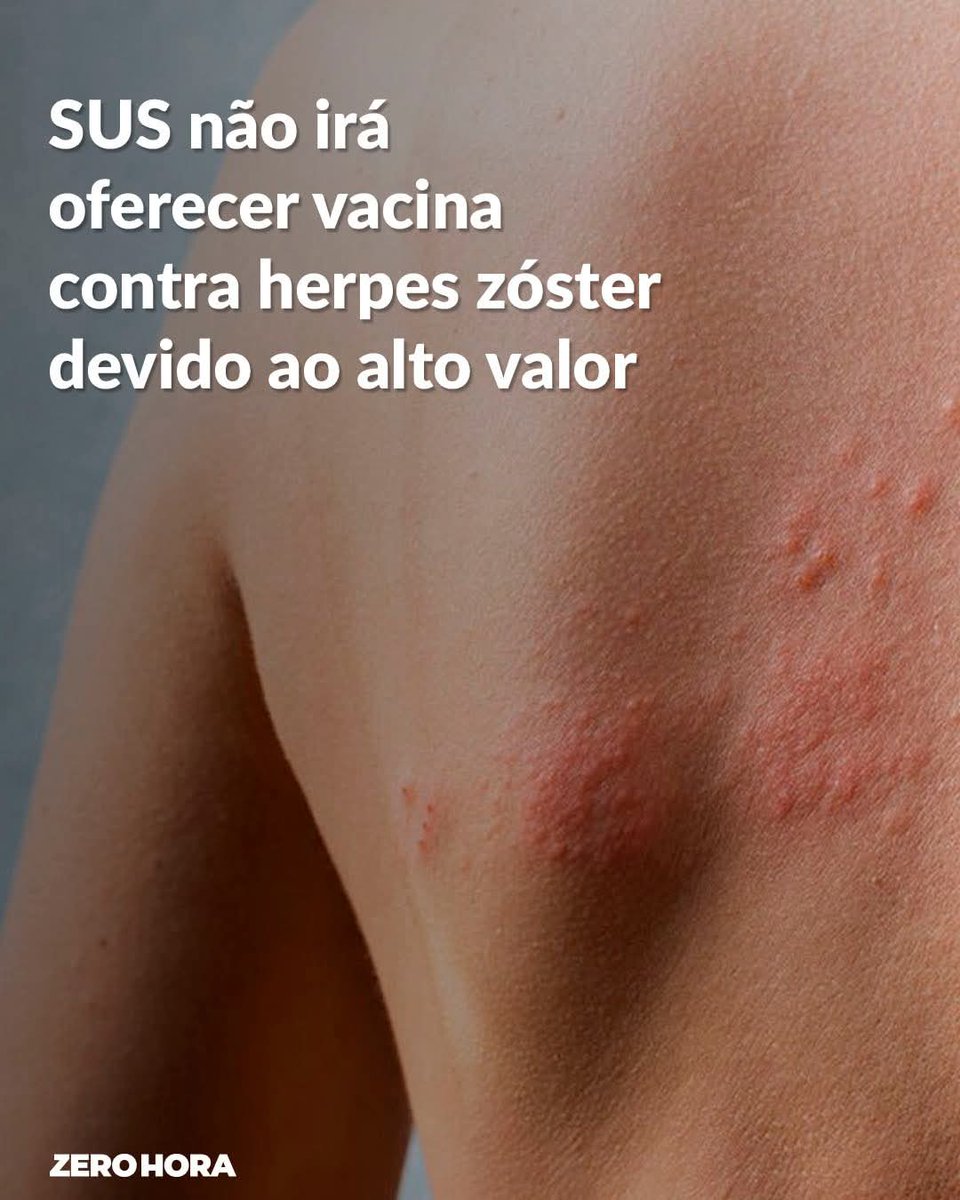 Tira uma vacina importante de quem sofre com esta doença que provoca dores absurdas, mas põe silicone em quem se identifica como mulher.

"Viva o SUS".
✊🏻