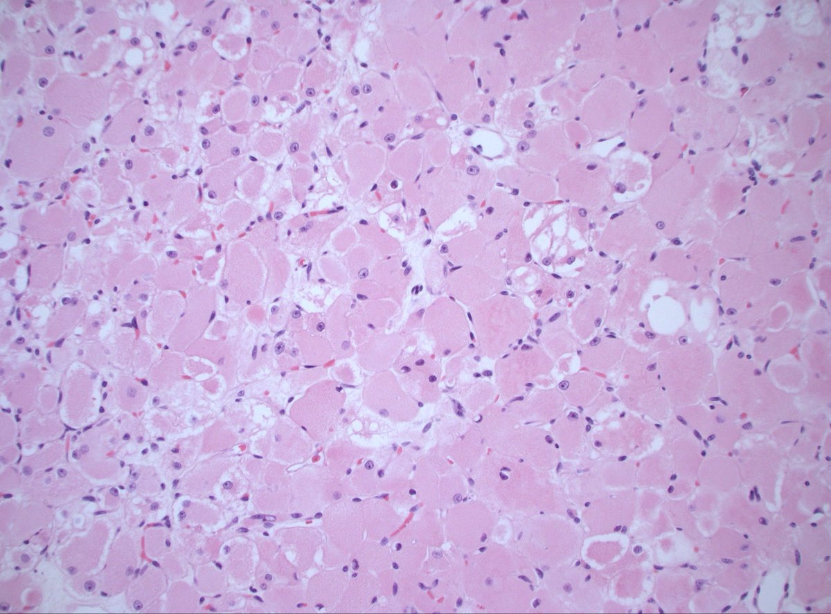 Dan Graham tweet media