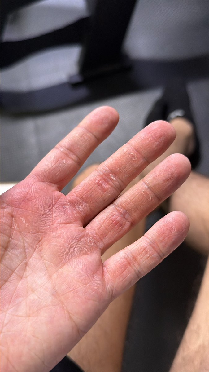 Nada. Me dolió más que me dejaran por WhatsApp.