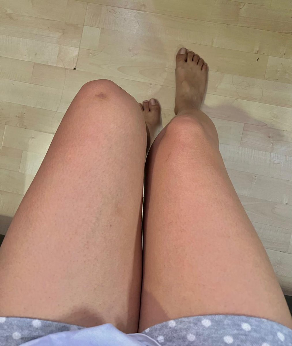 SunsetBlueVC's tweet image. x.com/xx515__/status… 
¿Quién quiere jugar con mis pies? 
😍🫦