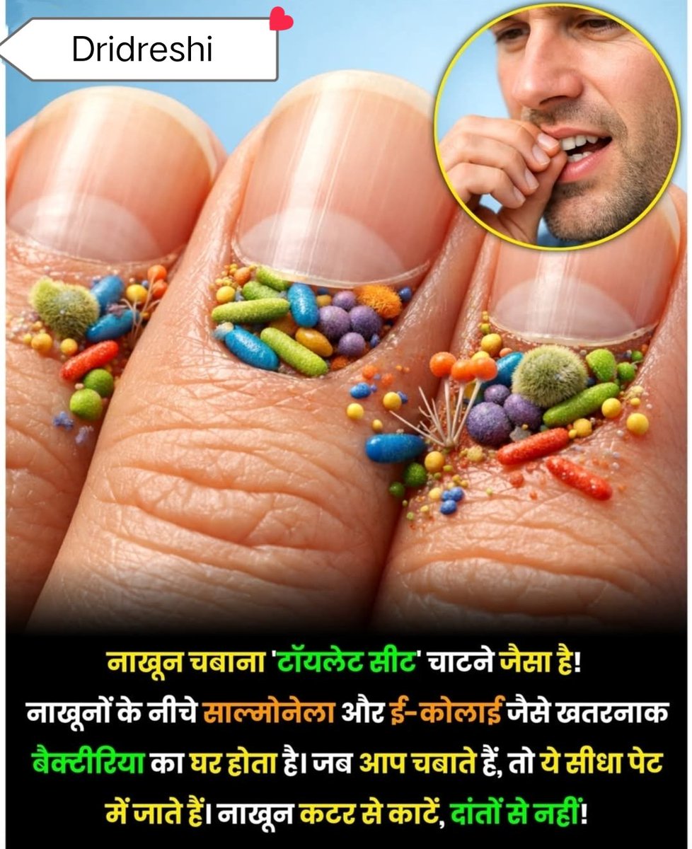 DrIdreshi's tweet photo. क्या कही आप भी अज्ञानता के कारण टॉयलेट की सीट तो नहीं चाट रहे हो
जी अगर आप मुंह से नाखून चबा कर काटते हैं तो ये ठीक वैसा ही जैसे टॉयलेट की सीट चाटना, क्योंकि नाखूनों के अंदर बहुत ही खतरनाक बैक्टेरिया होते है जैसे टॉयलेट की सीट पर, इससे बचे और सेहत का ख्याल रखें #health #Dr_Write https://t.co/HqKTcMZ3bX