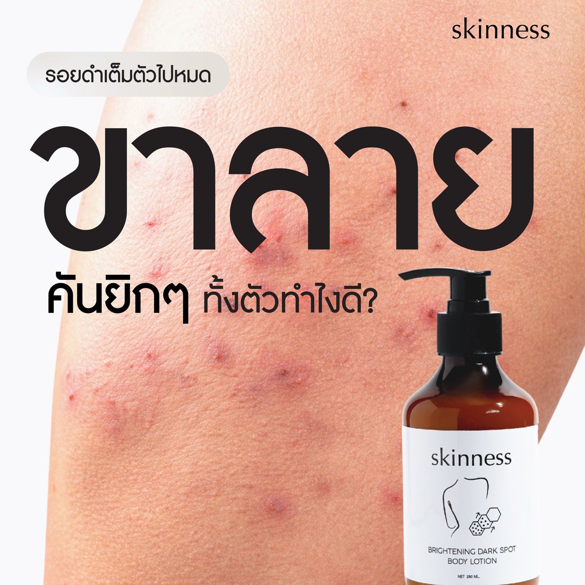 skinness official tweet media