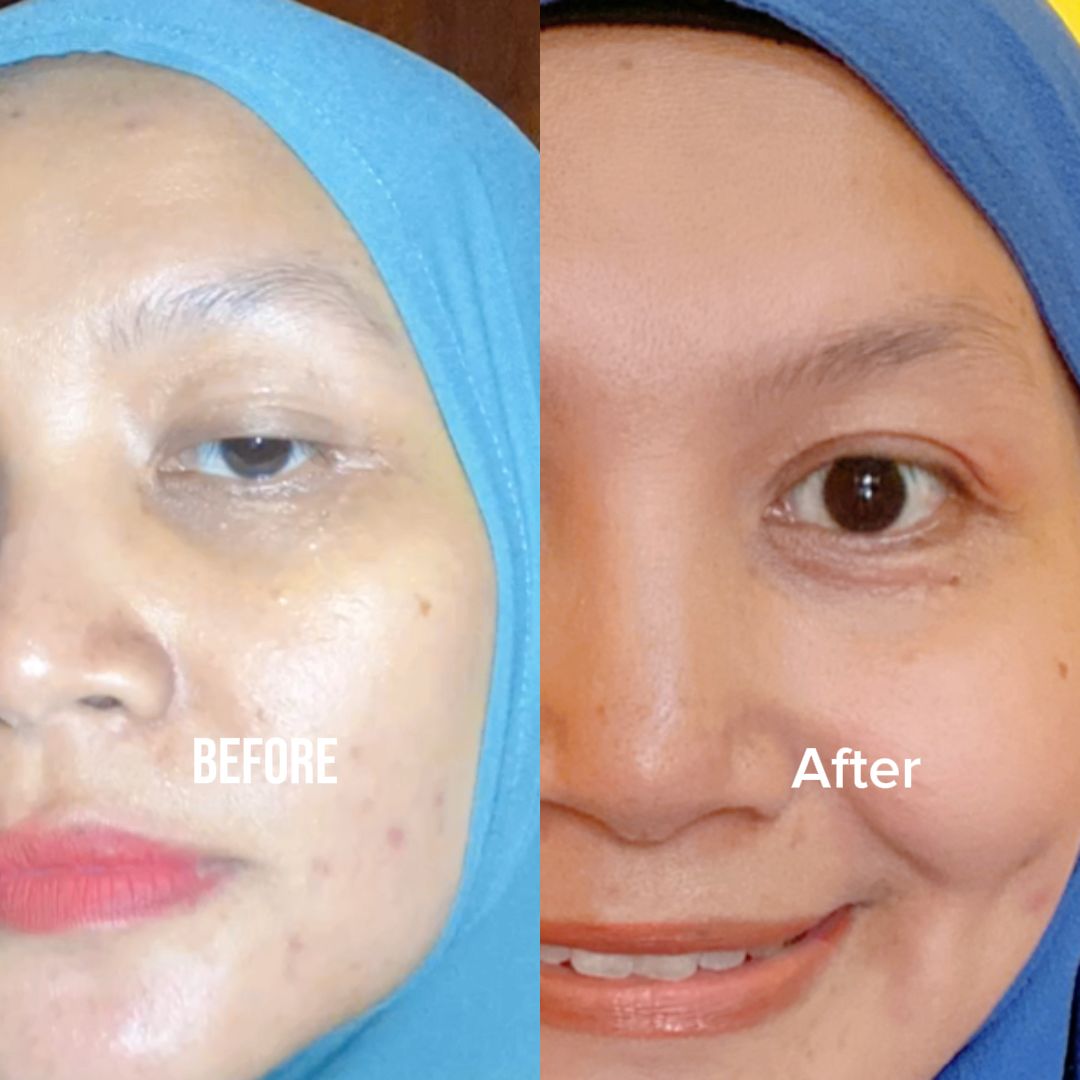 AnnaDoraemon's tweet photo. Aseli gak nyangka bgt, wajah jadi halusan gini hanya modal 29k ?😲 
Kaget ples Happy karena hanya modal olesin ini rutin hasilnya no muka kusam, flek hitam dan gradakan lagi
#Theraskin #AHA6 #AHA10 #AHA8 #GLYCOLICACID #GENTLEEXFOLIATE https://t.co/k5CHWcBHFW