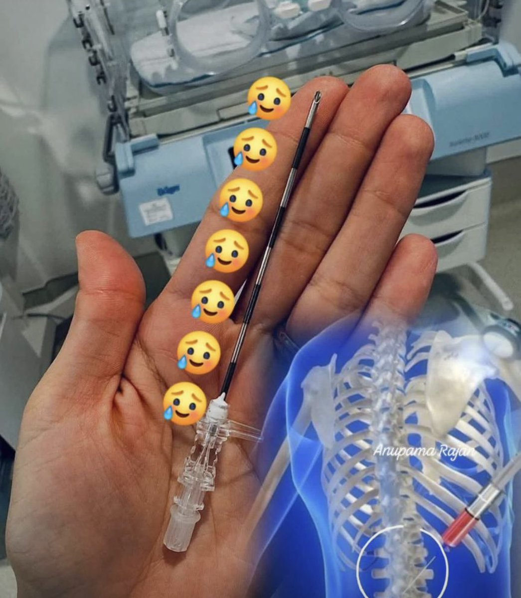 olu_semilore's tweet image. This is an epidural needle 🥺
Long, sharp and terrifying.
It goes deep into a mother’s spine,
While she’s already breaking with contractions.

Yet she bows her back, stays still and takes it.
Not because it’s easy but because her baby is worth every pain ❤️

C-section is not for…