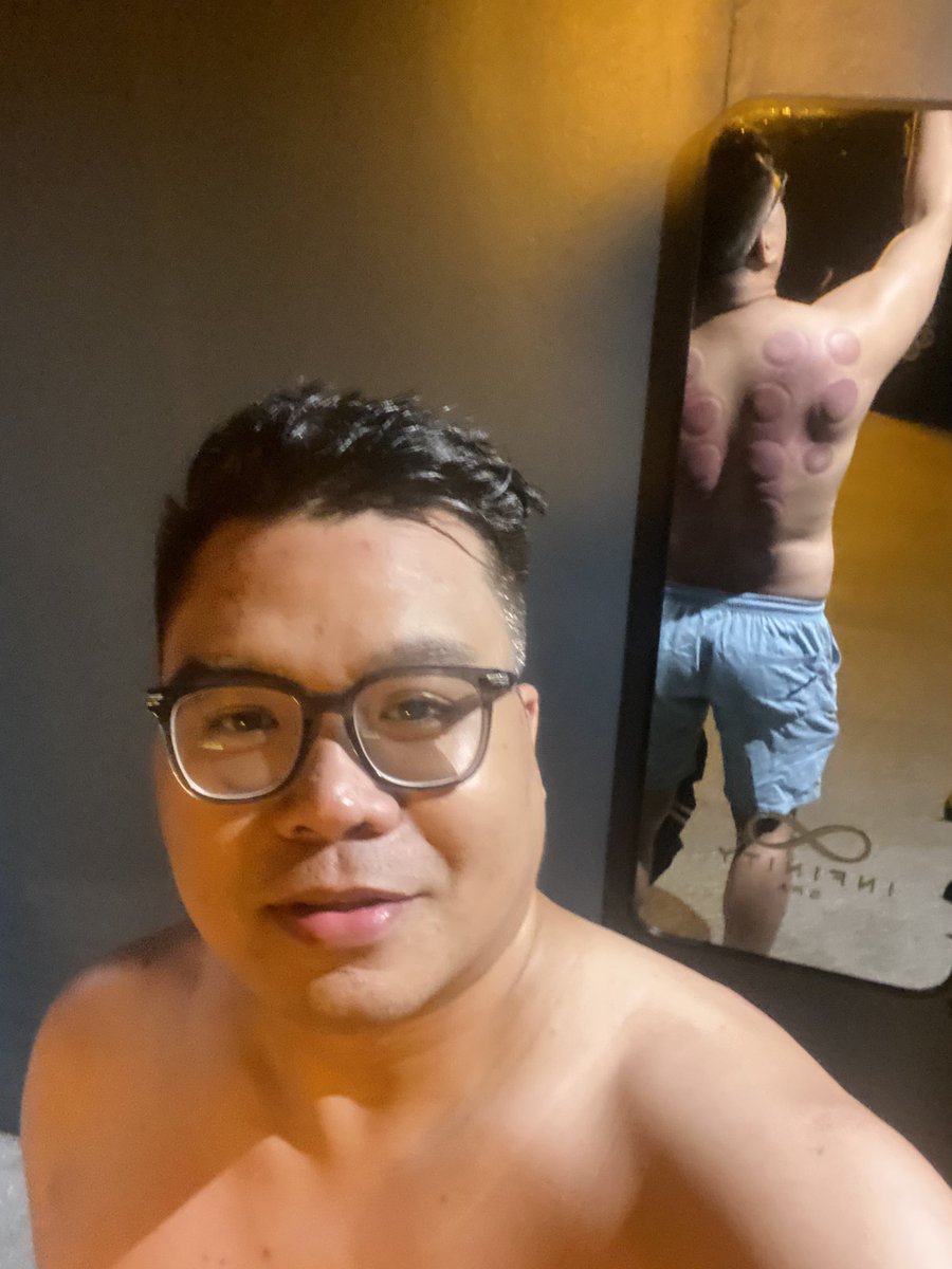 Badly needed ventosa tonight. 🙌