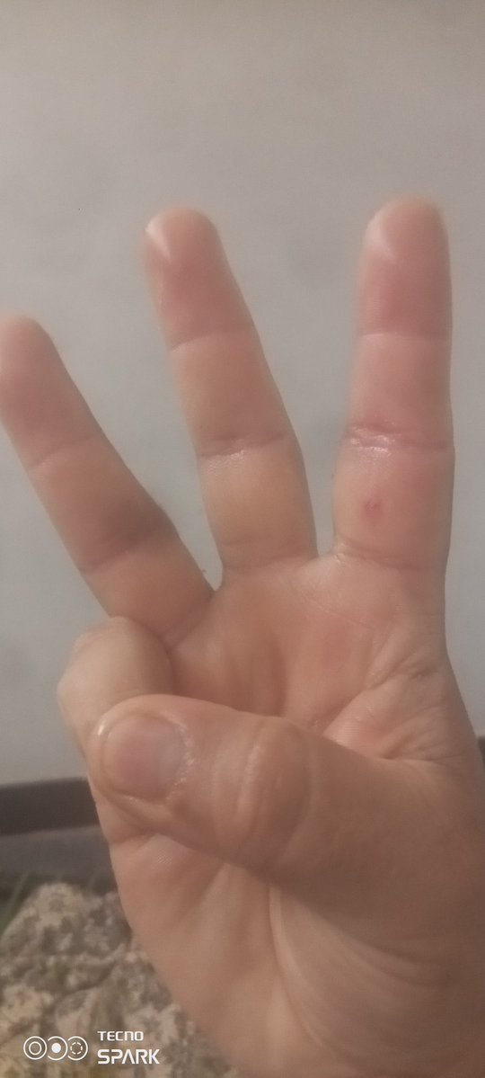 MuhammadIs15152's tweet image. Watcher Node Everywhere in Pakistan
#WatchersEverywhere