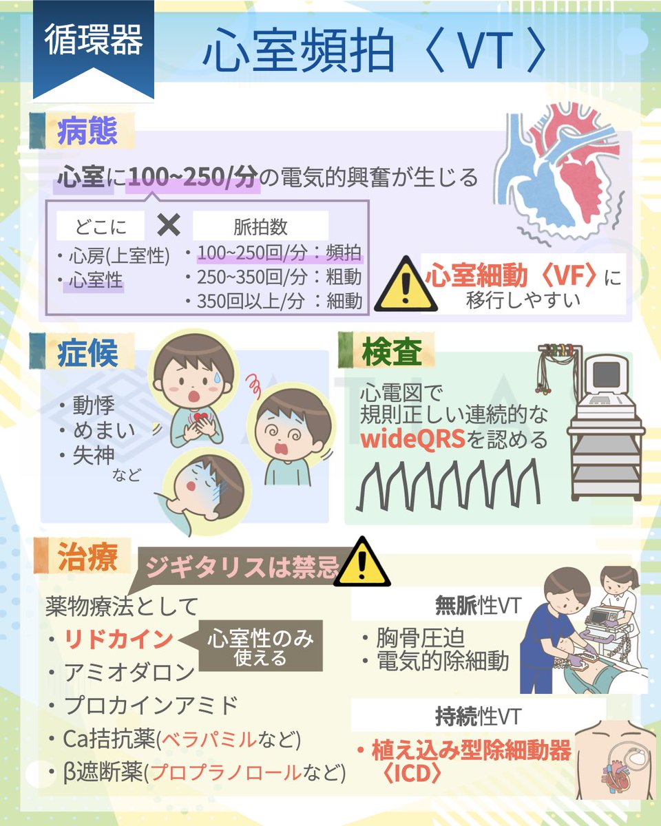 心室頻拍〈VT〉を一枚の画像にまとめてみました！ 毎週画像で分かりやすく解説もしているので、是非フォローしてみてください！  また、もっと詳しく知りたい方はフル動画も見てみてくださいね！