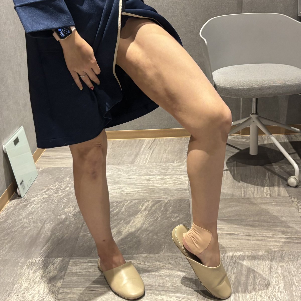 hrch_213's tweet image. 脂肪吸引を考えてるみなさん、先生選び間違えるとこんな事になります😇😇😇
私は某クリニックで脂肪豊胸のために脂肪吸引をしたんだけど取られ過ぎてこんな凸凹になりました。
ちなみに脂肪豊胸もほぼ定着せず、しこりが大量に出来て除去手術に50万円かかったよ💸