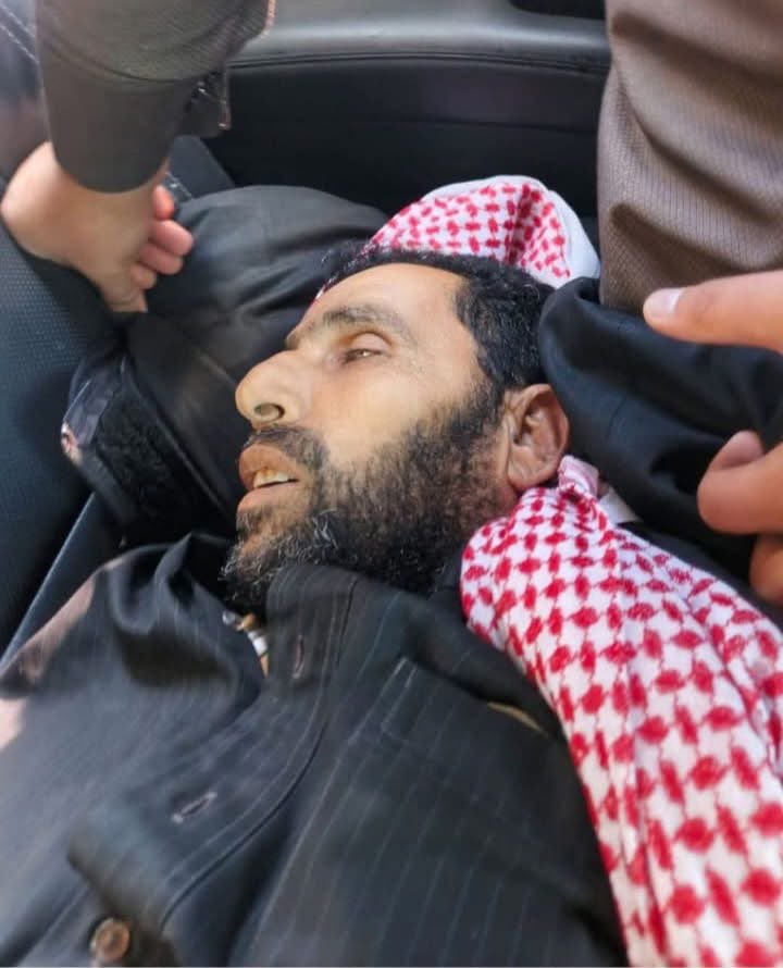The SDF militias killed Mr. Mohammad Hamoud Al-Shahada while he was accompanying his wife, who suffers from cancer, to receive treatment. They were traveling from the village of Umm Al-Baramil in the Suluk countryside, an area under Syrian government control, toward the city of