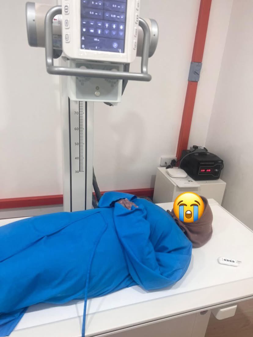 Doktor tersilap pasang IUCD hingga tembus rahim, wanita disahkan tidak boleh beranak normal seumur hidup. Prosedur di sebuah klinik di Johor berakhir dengan alat itu menembusi dinding rahim. Pesakit mengalami trauma akibat kejadian tersebut.