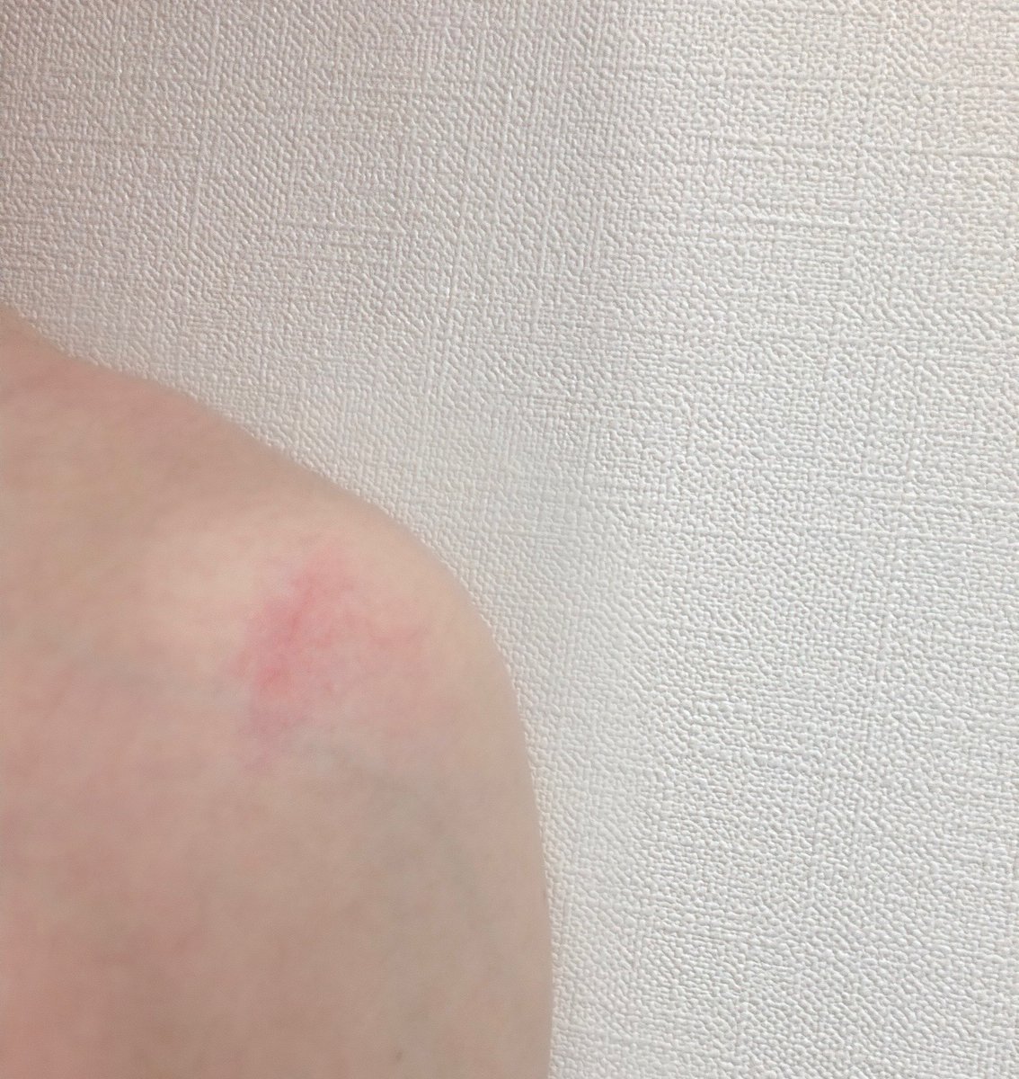 クローゼットの扉に肩ぶつけた、、
シャワーが沁みるぜ、、