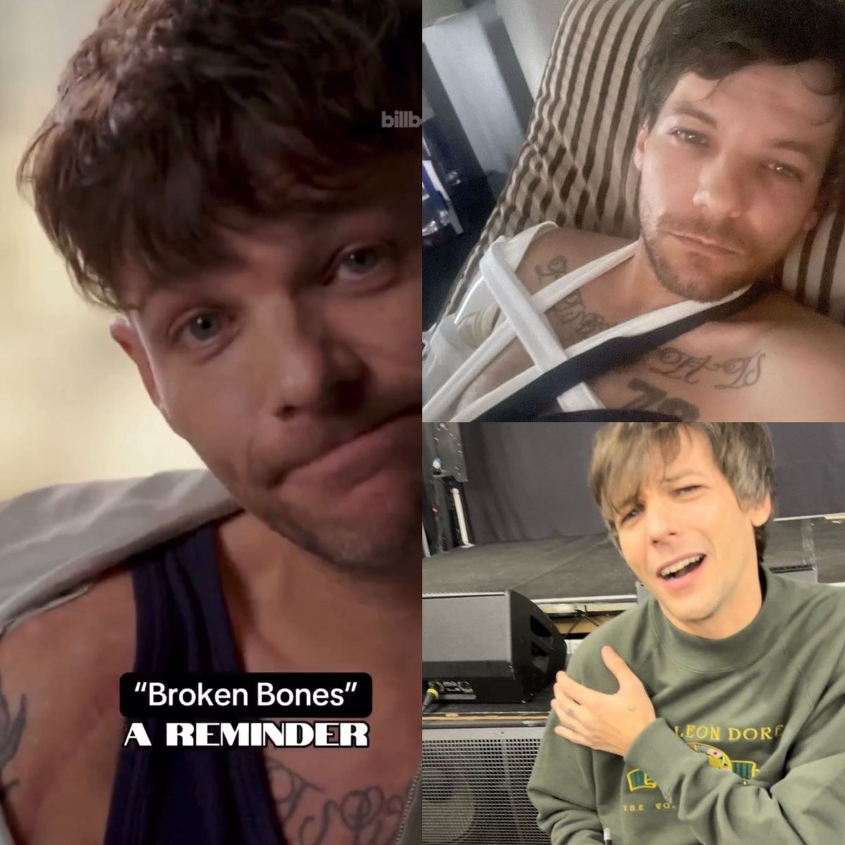 t91loupics's tweet image. broken bones is about a reminder