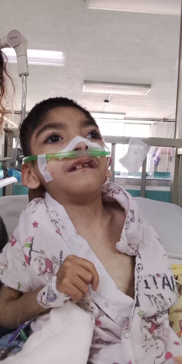 VinicioTVGT's tweet image. SERVICIO SOCIAL.
Madre desesperada, sin recursos económicos, solicita 5 DONADORES DE SANGRE para su hijo José Valentin Hernández Torres, quien tiene microcefalia y está grave en el Hosp. San Juan de Dios. Si usted puede donar sangre llamar al ☎️ 4193-6954 con Maribel Hernández.