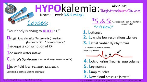 AB_drmd's tweet image. ✅ببساطة: في ال Hyperkalemia تركيز البوتاسيوم في الدم يكون عالي، و هذا يغير الـresting membrane potential حق الخلية (خصوصًا خلايا القلب). الطبيعي إن البوتاسيوم يطلع بره الخلية و يحافظ على فرق الشحنات، لكن لما يزيد K⁺ بره، يصير الـresting potential أقل سالبية (depolarized)، و هذا…
