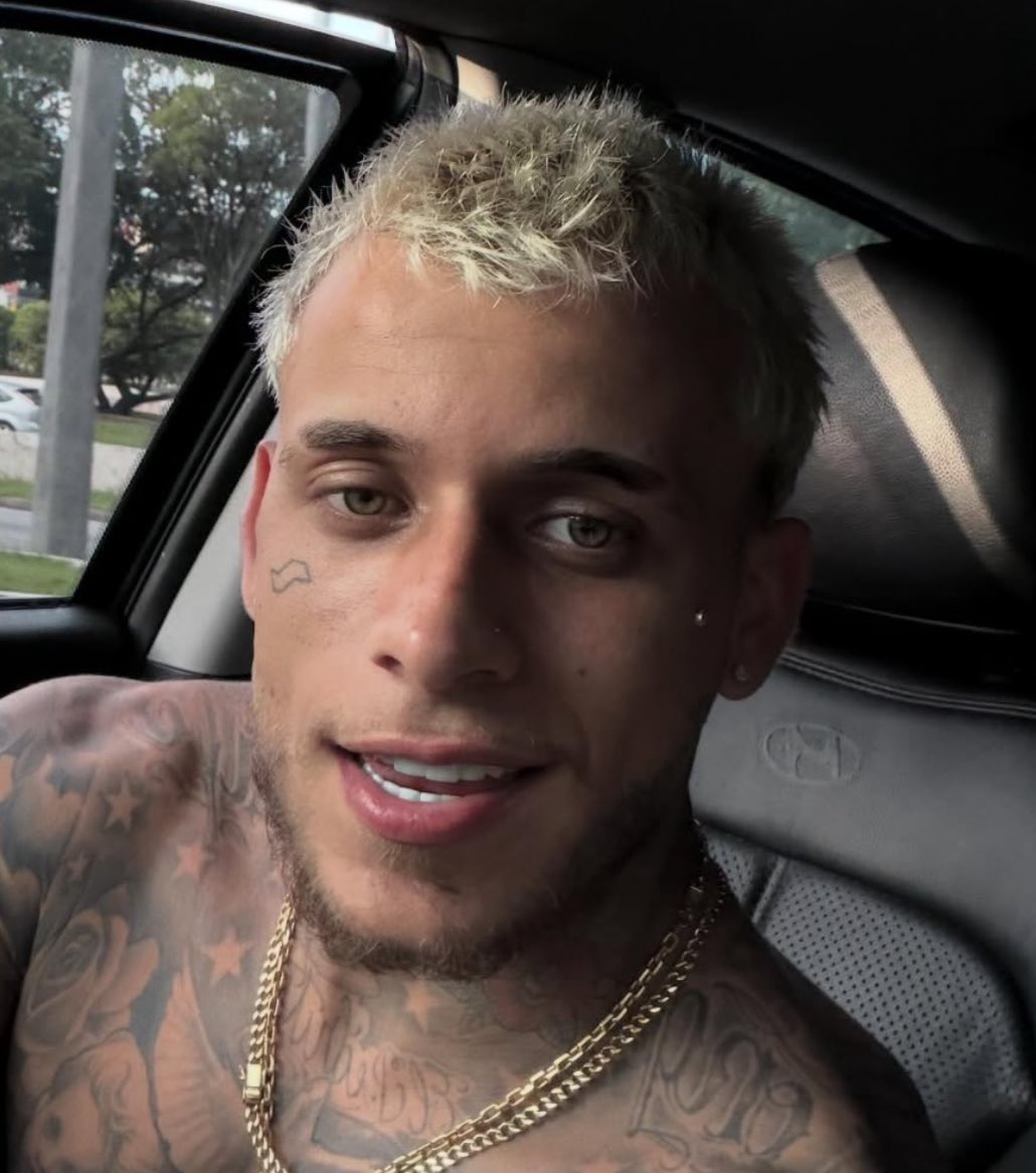 QGdoPOP's tweet image. Mc Pedrinho realiza transplante capilar e mostra o pós com inchaços.