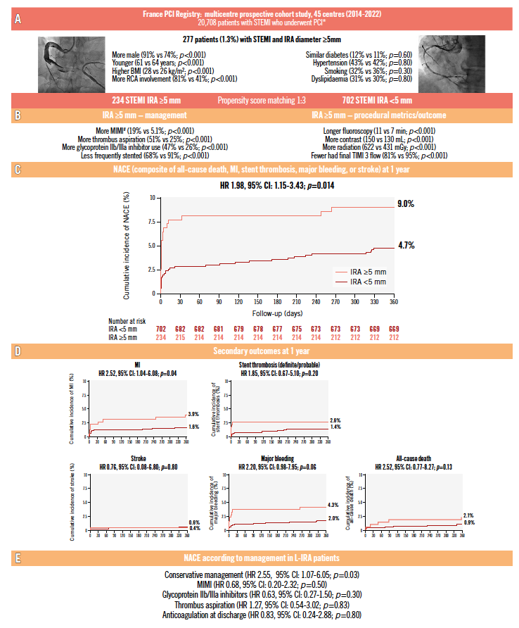 EuroIntervention tweet media