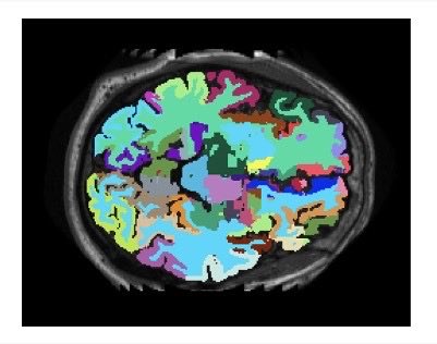UNIMORE_univ's tweet photo. Lunedì 19 gennaio,  dalle ore 15, presso la Facoltà di Medicina e Chirurgia, approfondiremo uno dei temi più strategici per il futuro della scienza e della medicina: l’intelligenza artificiale applicata alla ricerca biomedica. È previsto l’intervento della Rettrice Rita Cucchiara https://t.co/L4jYDXXcZ1