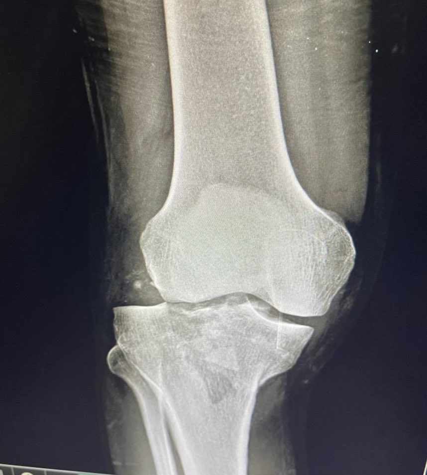 Haseeb Gani tweet media