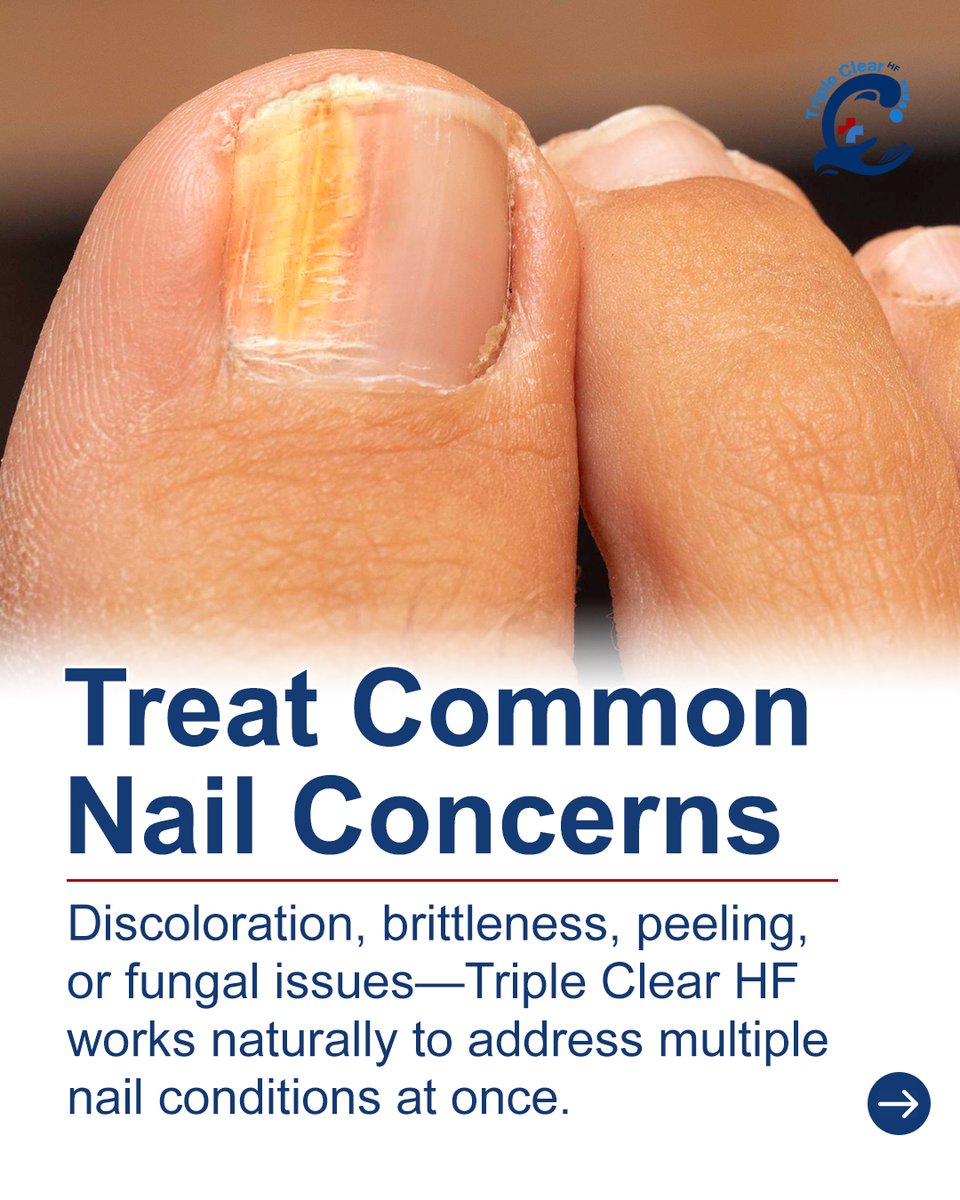 TripleClearHF's tweet image. Consistency matters in nail health.

Triple Clear HF treats multiple nail concerns while protecting nails through simple daily use.

Apply, absorb, and let steady care support healthier growth over time.

Start today at TripleClearHF.com.

#TripleClearHF #NaturalNailCare