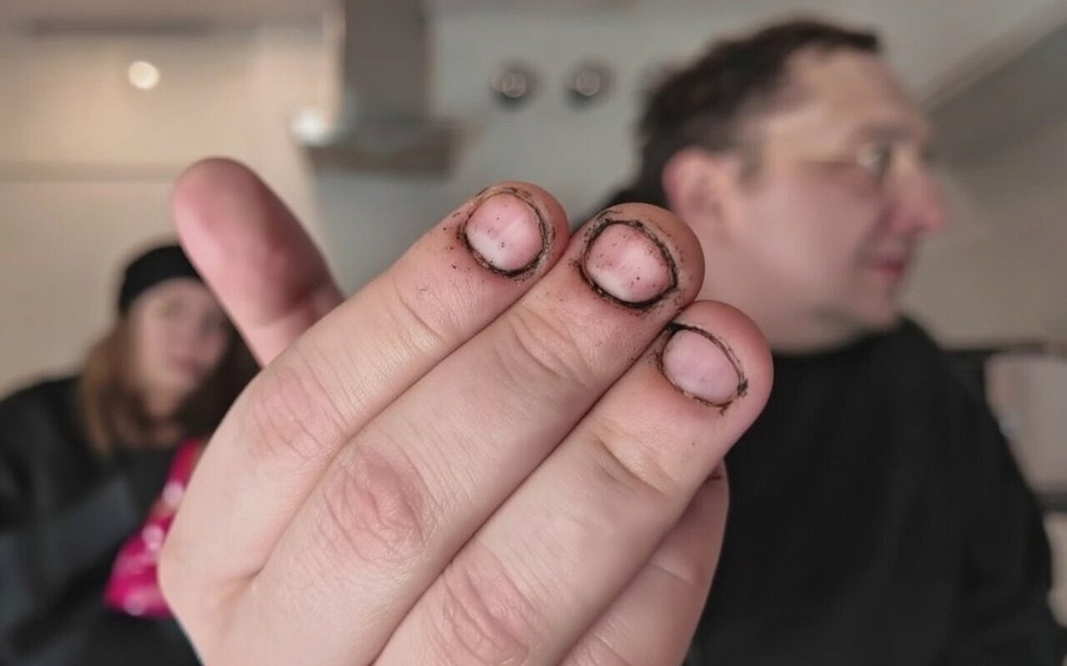 TotalnyChampion's tweet photo. Spoko takie paluchy? Pewnie Natalka Magical całe se do ryja wkłada Xd https://t.co/8IvKlFtqHU