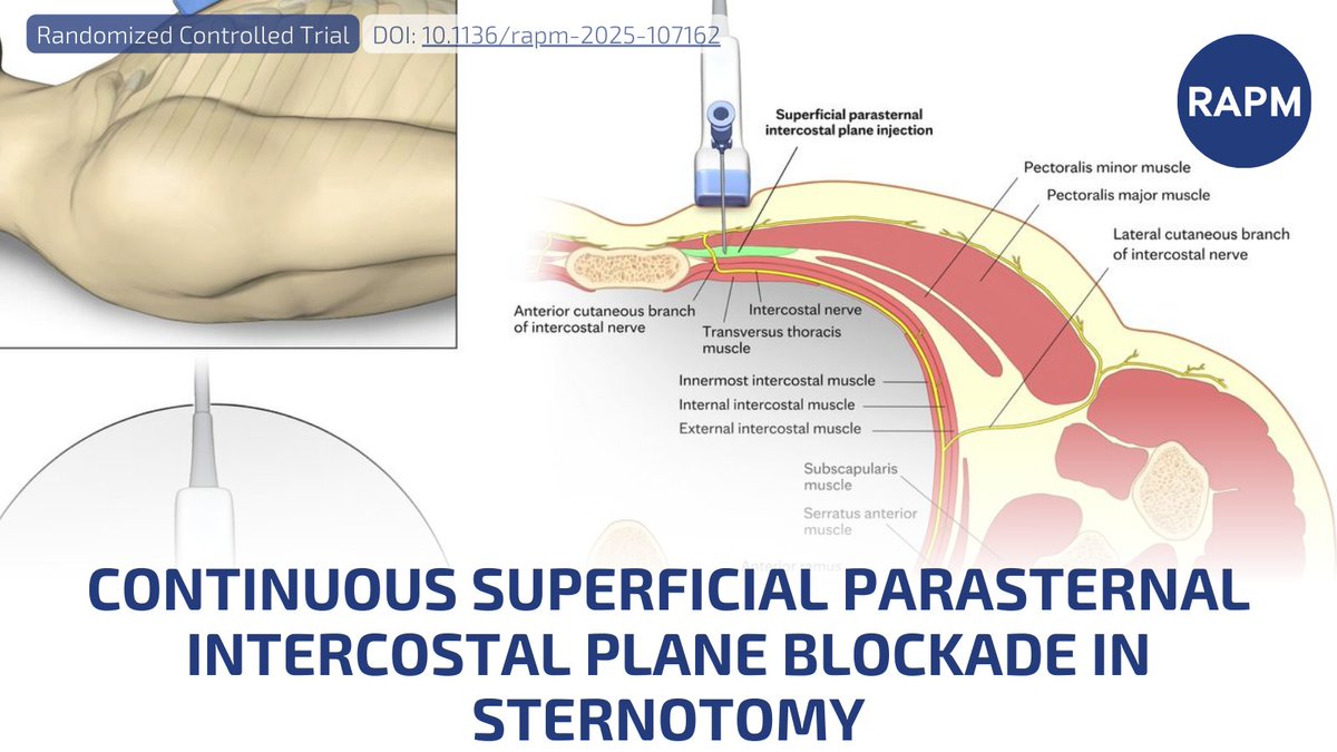 Regional Anesthesia & Pain Medicine tweet media