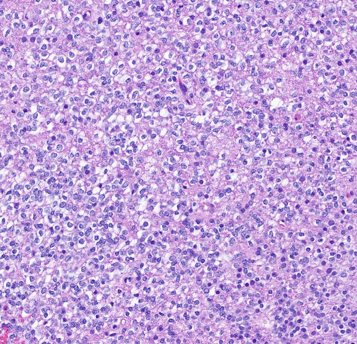 Craig Horbinski tweet media