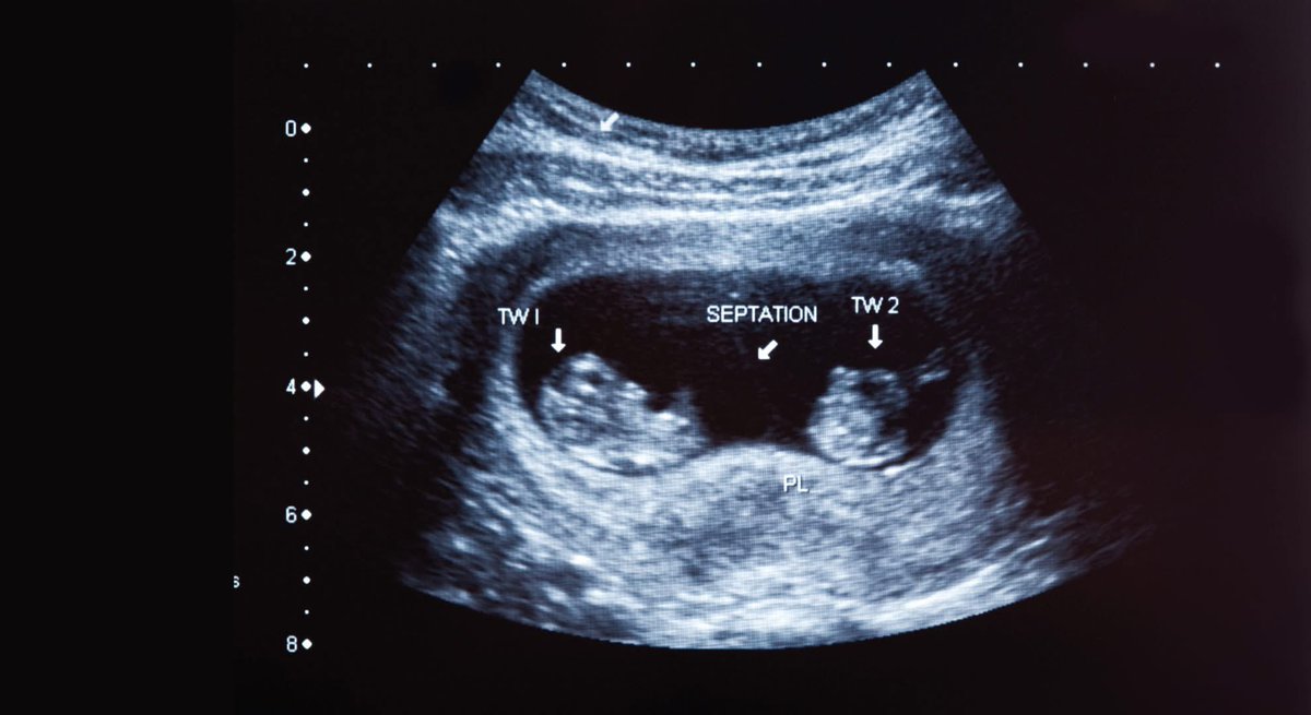 𝐕𝐢𝐨𝐫𝐢𝐤𝐚_𝐚𝐫𝐭 tweet media