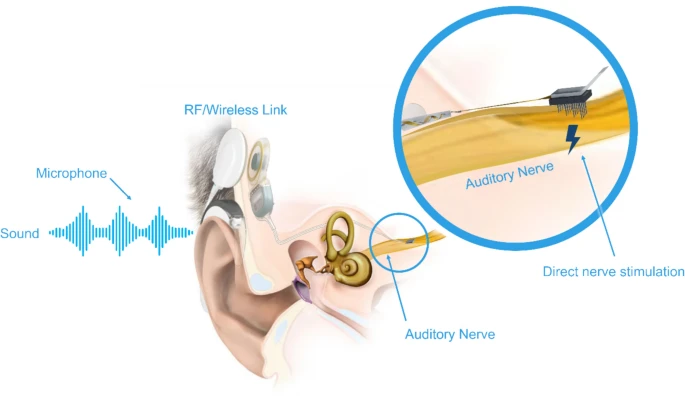 Bioelectronic Medicine - Journal tweet media