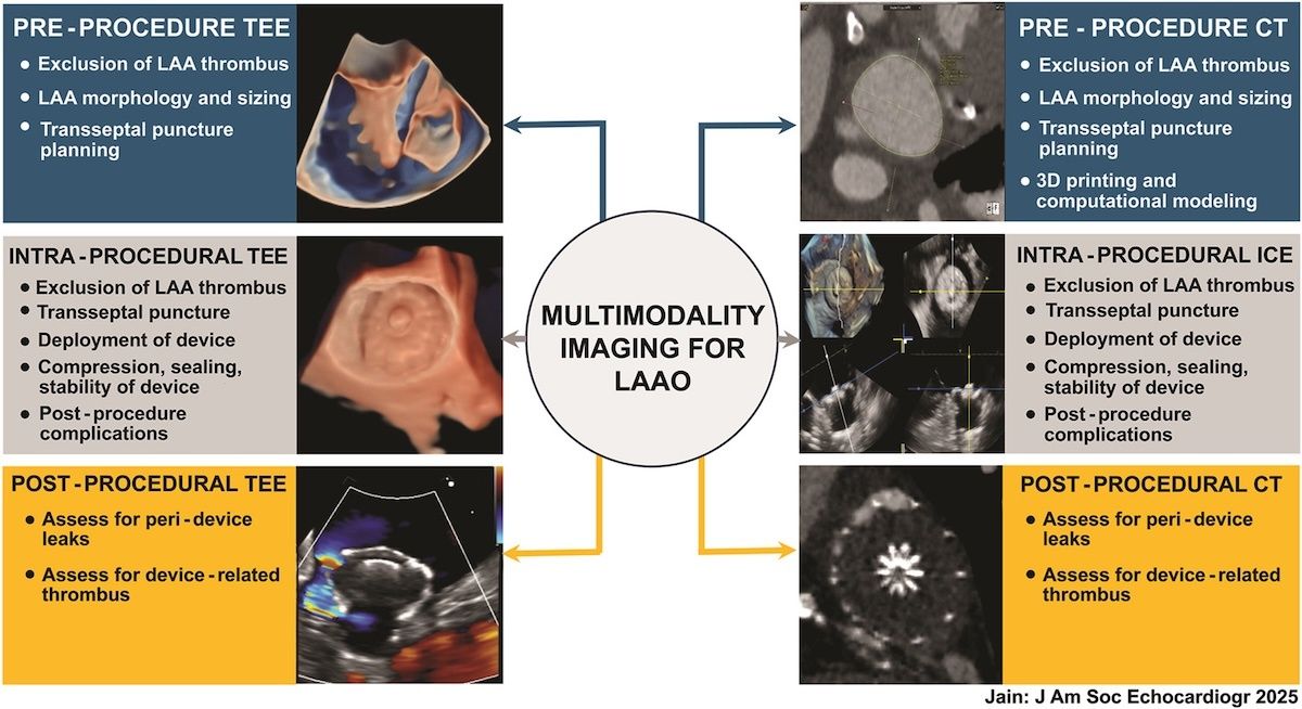 SEIC - Sociedad Española de Imagen Cardíaca tweet media