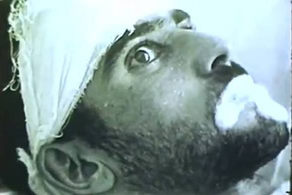 IanCopeland5's tweet image. Silly antivaxer. 

The Rabies vaccine is a vaccine.

It prevents symptoms of Rabies both before or after exposure.

The only way to survive Rabies exposure is vaccination after a bite, lick or scratch from a Rabid animal.

Once symptoms start, you're dead...