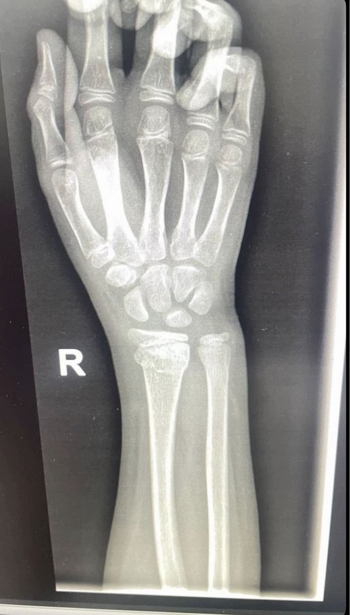 ColdAware's tweet image. كس الديمبسي رول على كس خلايا عقلي الله يلعن البوكسينق على اللي جاب البوكسينق وعلى ايبو بأذن الله تموتون كلكم كلكم واحد واحد