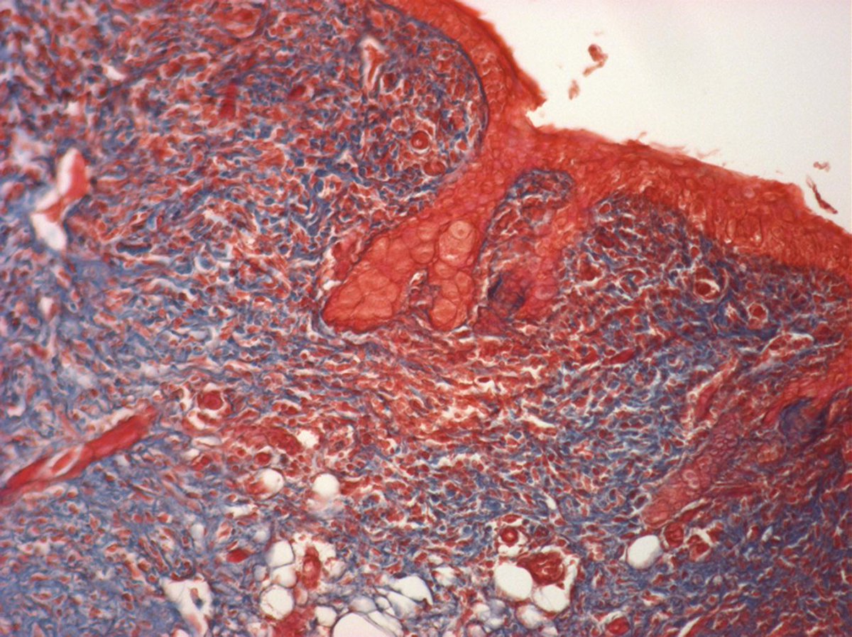 Justin Varholick tweet media