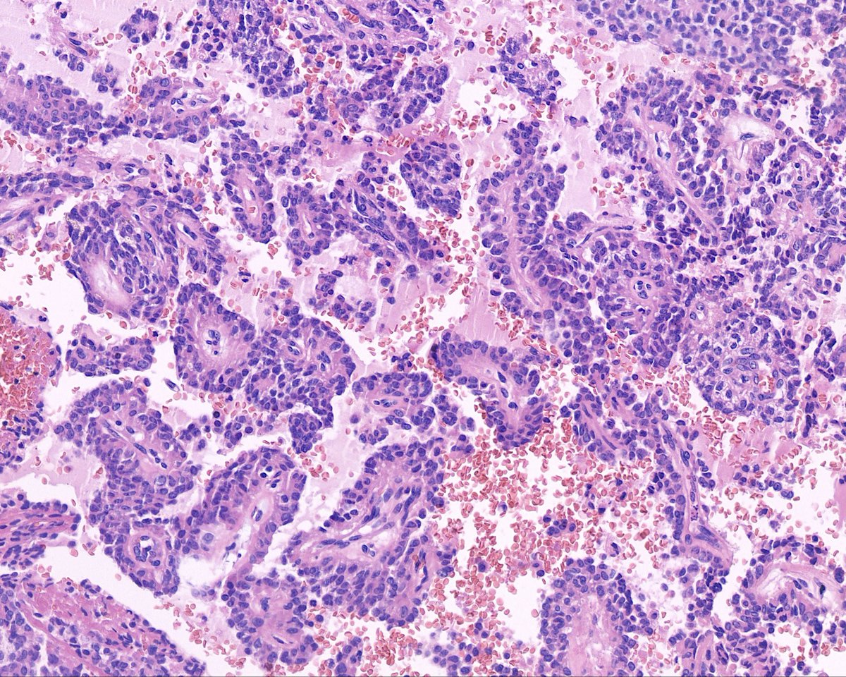 Surgical Pathology Cases tweet media