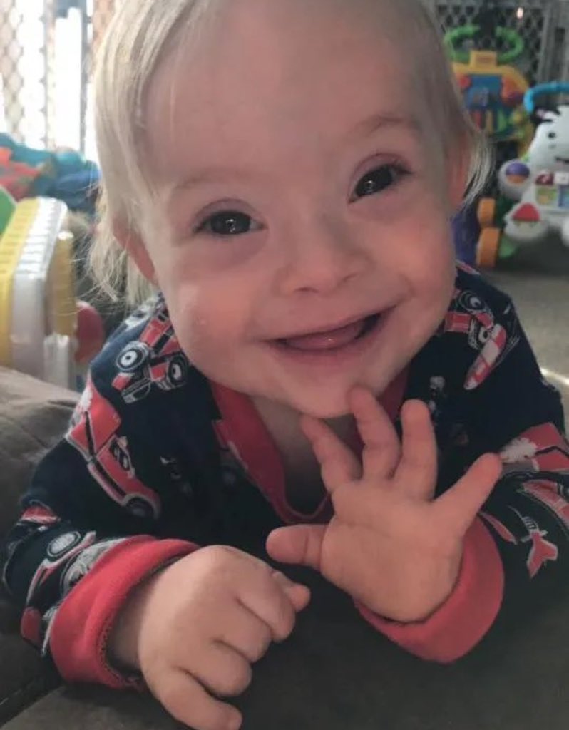 annamlulis's tweet image. This child, with an extra chromosome, is valuable and worthy of life.