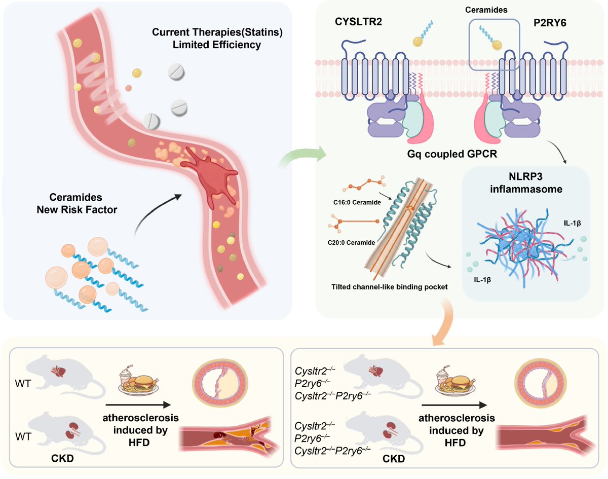 MaximumAcademic's tweet photo. #Targetome
Ceramides predict heart risk solo; Zhang finds they hijack CYSLTR2/P2RY6, sparking plaque. Block the duo, cut inflammation, ignore lipids. 🫀🎯
@NeuronsInc @DetroitNeurons #risk #inflammation #block
Details: https://t.co/djd8bpyvRJ https://t.co/LJN9DxSFfM