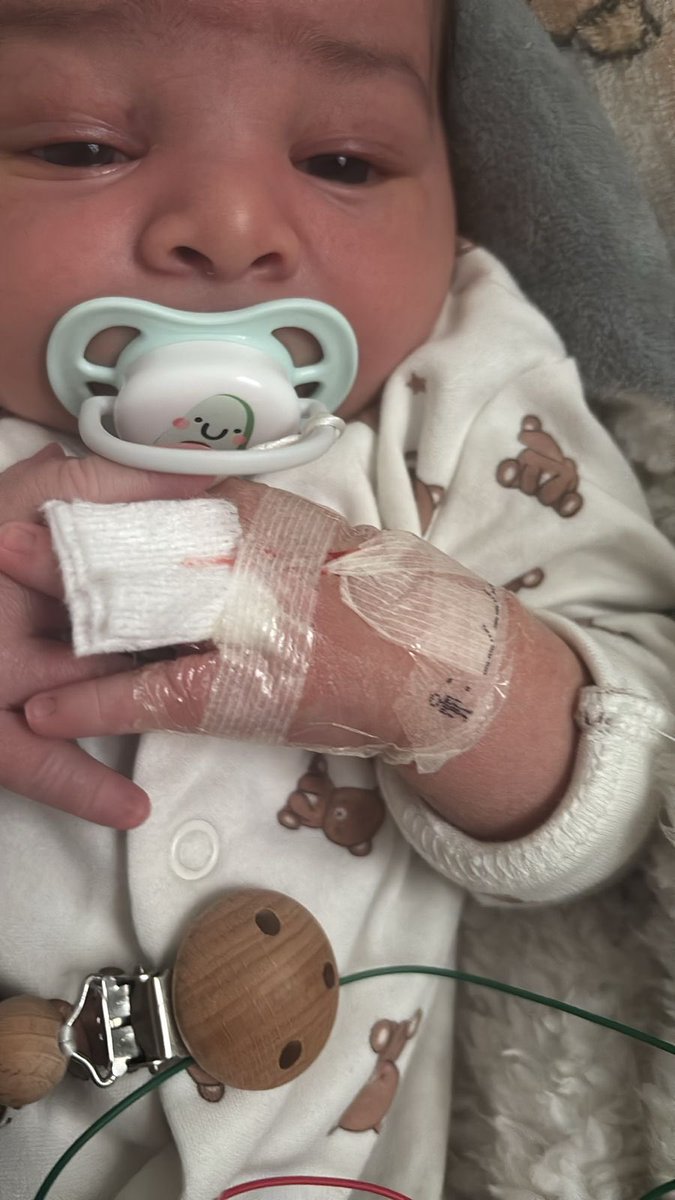 Aujourd’hui en #France on a le droit de s’acharner sur un #bebe 
Mon pauvre bébé devenu un cowbay expérimental aux mains d’un personnel exerçant illégalement la fonction d’un médecin <a href="/stephanie_rist/">Stéphanie RIST</a>