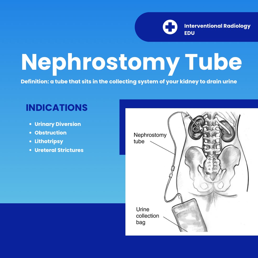 UTSW Interventional Radiology tweet media