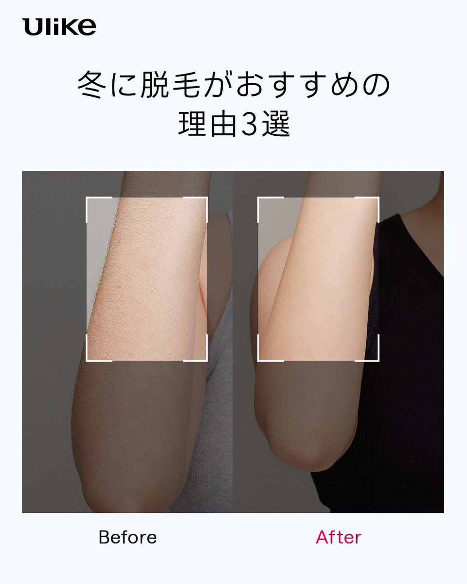 Ulike（ユーライク） (@Ulike_JP) / Posts / X