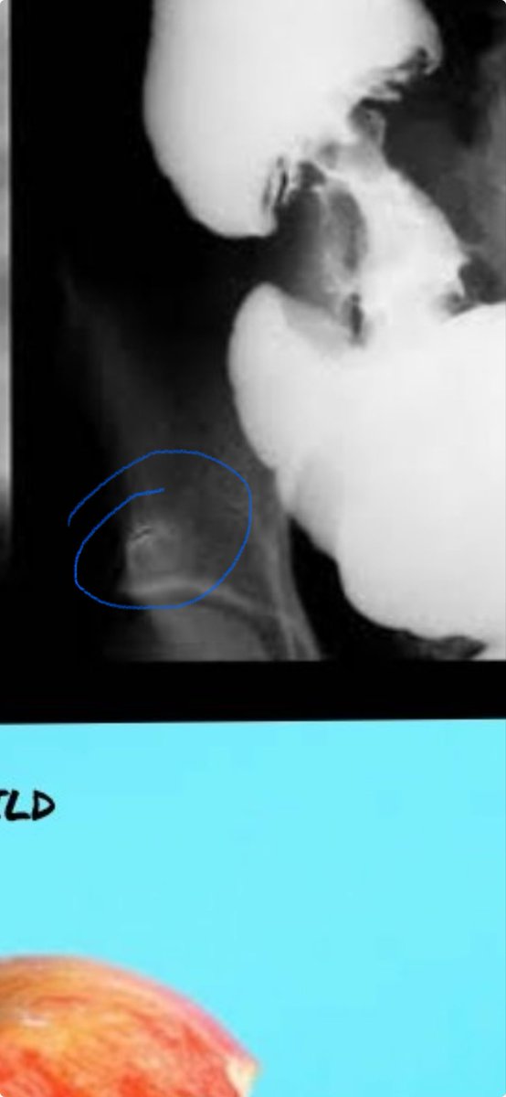 Bubbba Buffett tweet media