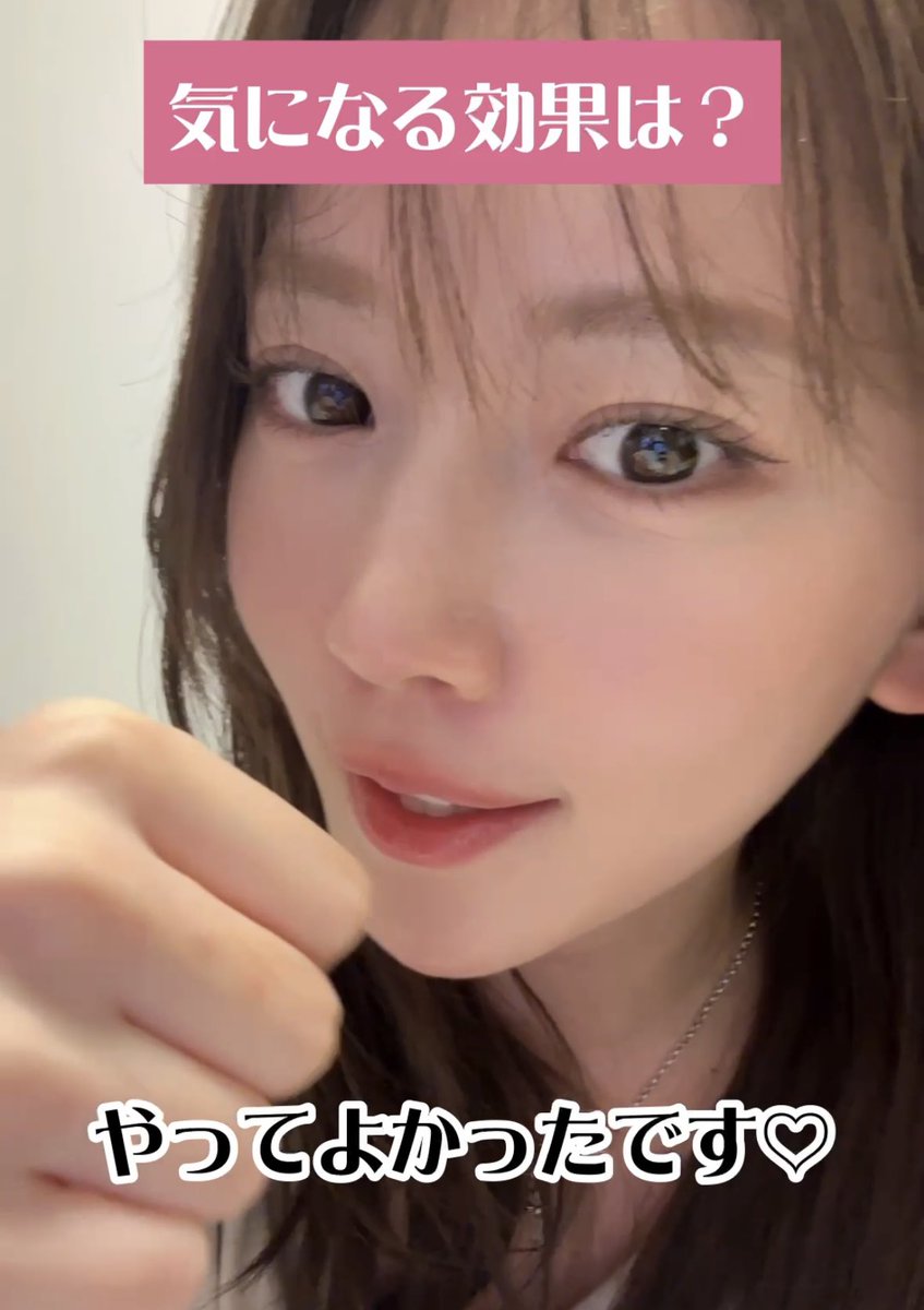 韓国美容医療通インフルエンサー、Uchanさえも唸らせた日本のあのクリニック....㊙️
Uchanが受けた施術はこちら！✨
実際の施術の様子やレポはインスタを見てみてね〜！！
instagram.com/reel/DSMxLBfEu…