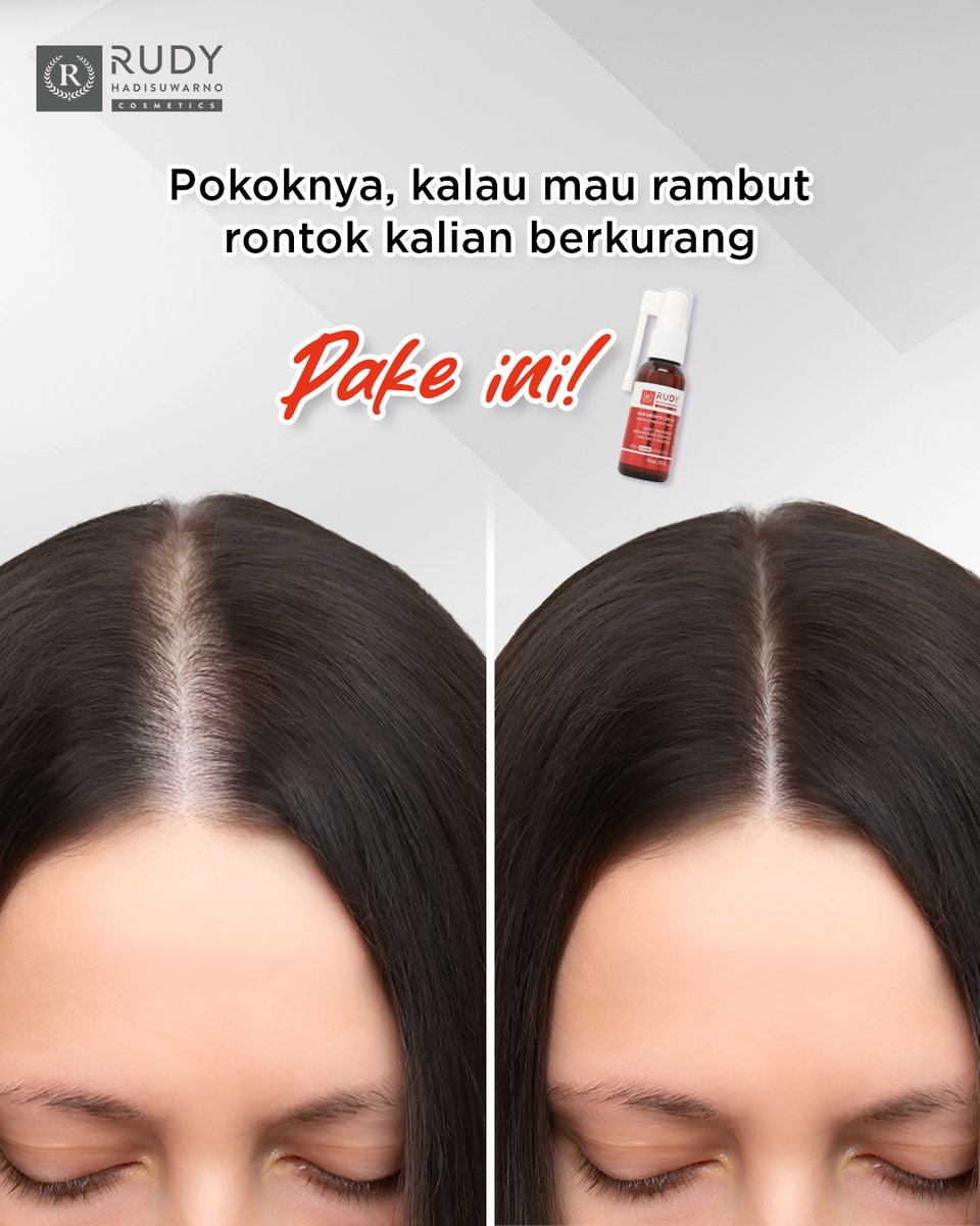 Kadang nggak perlu kebanyakan teori— yang penting konsisten, akarnya dirawat, dan rambutnya jadi lebih kuat

#RudyHadisuwarnoCosmetics #HairGrowthSerum #RambutRontok #ResepAntiRontok #ResepdariHairExpert #HairmonyExpert