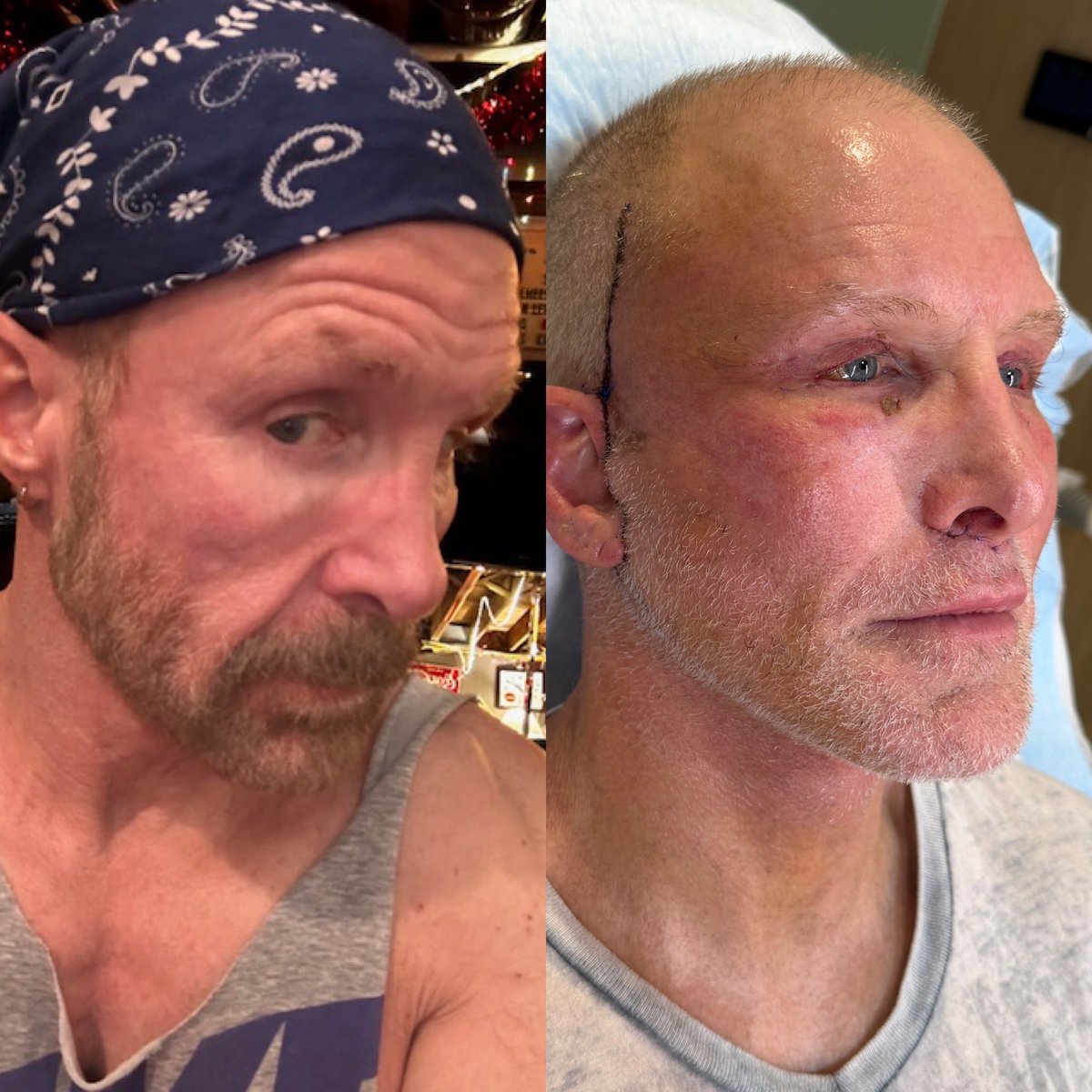 Dr. Jason Emer tweet media