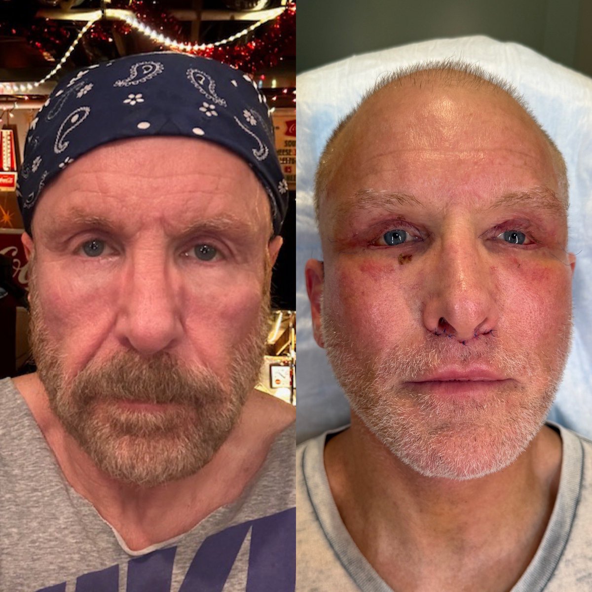 Dr. Jason Emer tweet media