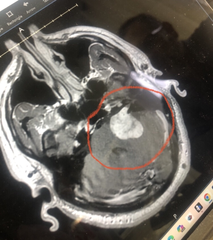 Hello everyone. o/ Ok so, I have good news and "OK" news. The good news is that my Dr released me form ALL restrictions to go back to work!  The "OK" news is that My Dr released me form ALL restrictions to go back to work! So what dose this mean?

1: I will be returning to work